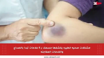 مشكلات صحية خطيرة يكشفها جسمك بـ 6 علامات تبدأ بالصداع والكدمات المفاجئة